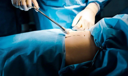 When Surgery Feels Like a Big Step: Understanding Abdominal Wall Care in a More Human Way